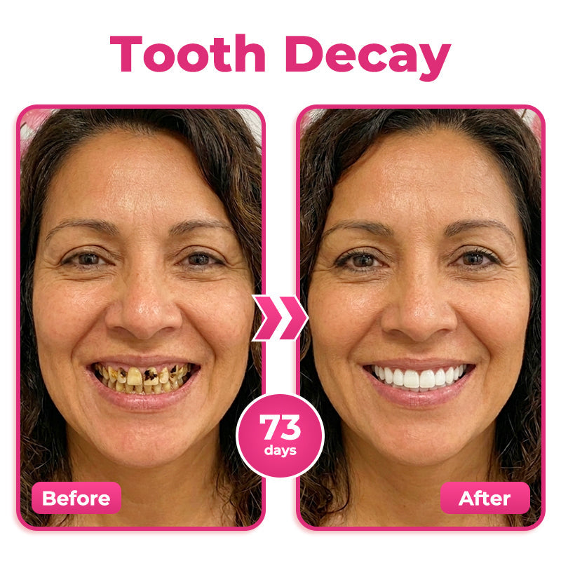 🎁 Only 5 bottles left! 50% OFF today! Restore a cleaner, stronger-looking smile with Natravor® NH-10. Say goodbye to stains, sensitivity & buildup — don’t miss this offer!