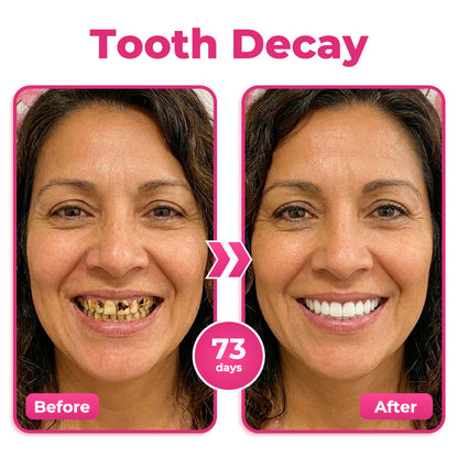 🎁 Only 5 bottles left! 50% OFF today! Restore a cleaner, stronger-looking smile with Natravor® NH-10. Say goodbye to stains, sensitivity & buildup — don’t miss this offer!