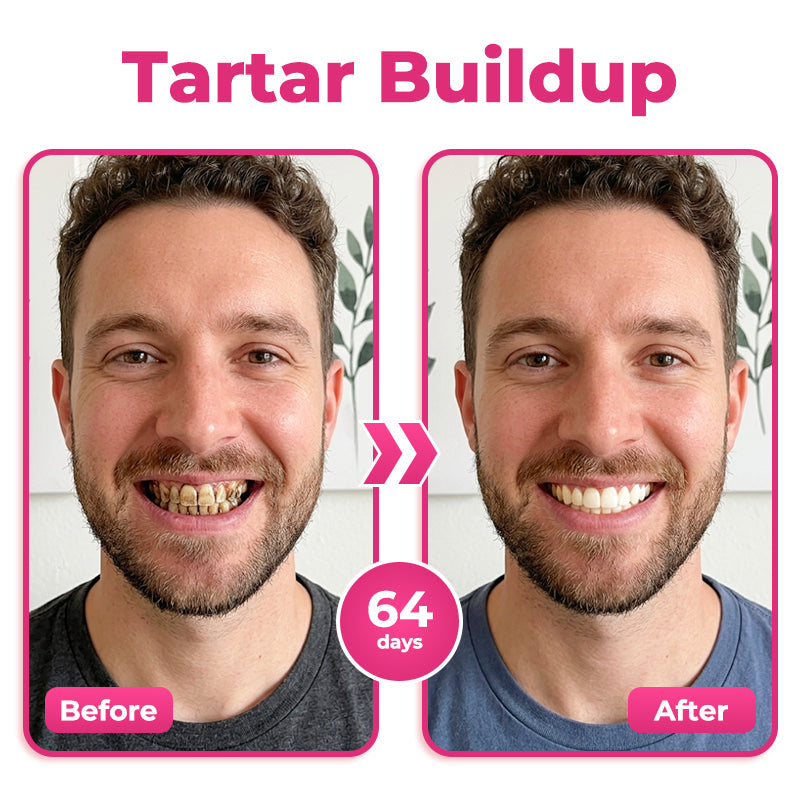 🎁 Only 5 bottles left! 50% OFF today! Restore a cleaner, stronger-looking smile with Natravor® NH-10. Say goodbye to stains, sensitivity & buildup — don’t miss this offer!