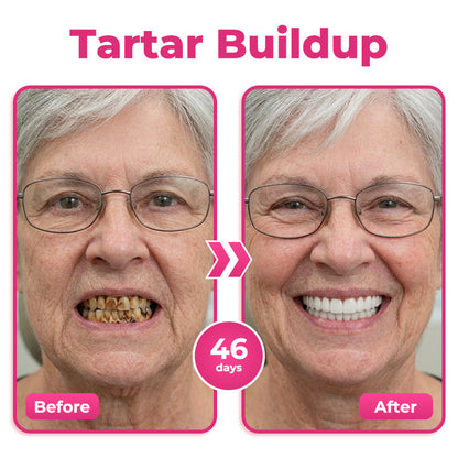 🎁 Only 5 bottles left! 50% OFF today! Restore a cleaner, stronger-looking smile with Natravor® NH-10. Say goodbye to stains, sensitivity & buildup — don’t miss this offer!