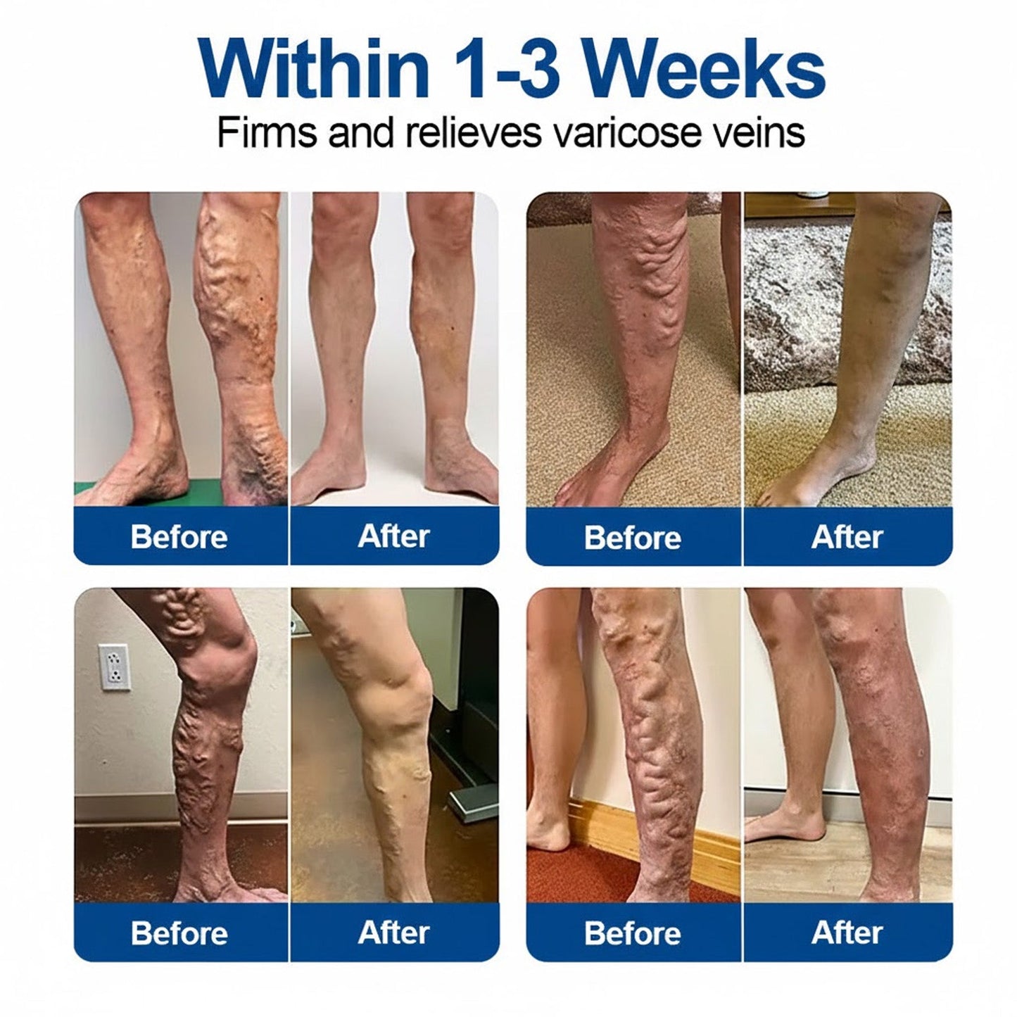🎁 Only 5 boxes left! We're offering an extra 50% off! 🦵 Say goodbye to tired, heavy, and swollen legs. Start your journey to lighter, more comfortable legs today — you won’t want to miss this special offer!