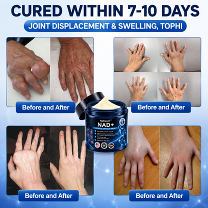 🔥Official Store:  🦵𝐍𝐚𝐭𝐫𝐚𝐯𝐨𝐫™ NAD+ Advanced Anti-Aging Joint Relief Cre am (Specially for mature adults & recommended for daily joint care)🔥𝑳𝒂𝒔𝒕 𝒅𝒂𝒚 𝒑𝒓𝒐𝒎𝒐𝒕𝒊𝒐𝒏 7𝟎% 𝒐𝒇𝒇