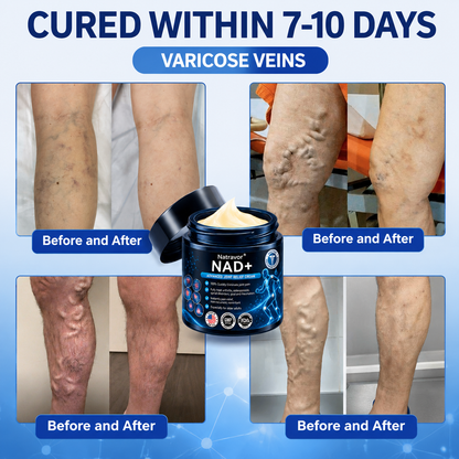 🔥Official Store:  🦵𝐍𝐚𝐭𝐫𝐚𝐯𝐨𝐫™ NAD+ Advanced Anti-Aging Joint Relief Cre am (Specially for mature adults & recommended for daily joint care)🔥𝑳𝒂𝒔𝒕 𝒅𝒂𝒚 𝒑𝒓𝒐𝒎𝒐𝒕𝒊𝒐𝒏 7𝟎% 𝒐𝒇𝒇