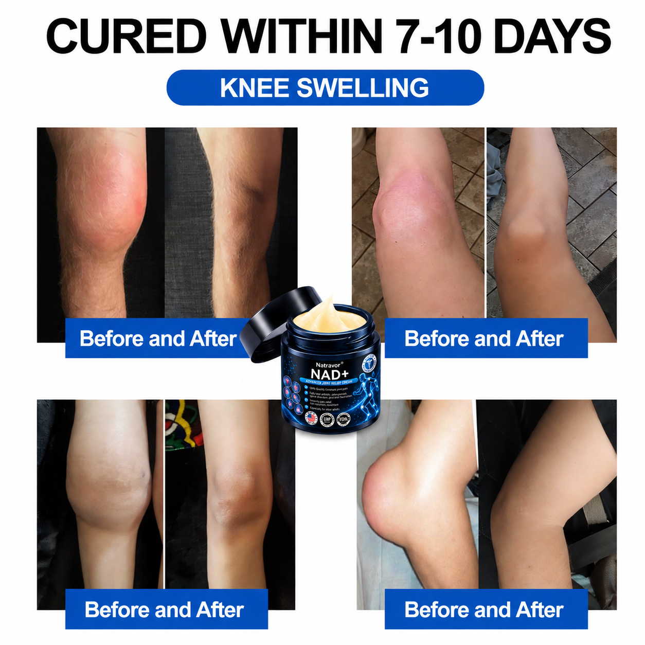 🔥Official Store:  🦵𝐍𝐚𝐭𝐫𝐚𝐯𝐨𝐫™ NAD+ Advanced Anti-Aging Joint Relief Cre am (Specially for mature adults & recommended for daily joint care)🔥𝑳𝒂𝒔𝒕 𝒅𝒂𝒚 𝒑𝒓𝒐𝒎𝒐𝒕𝒊𝒐𝒏 7𝟎% 𝒐𝒇𝒇
